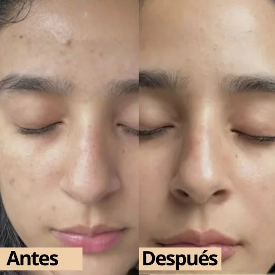 Dr Lumix™ Combo de Ampolla exfoliante rejuvenecedora con arroz coreano