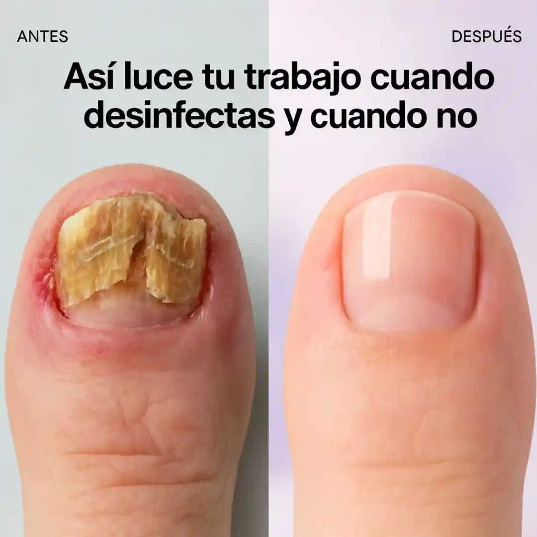 Olvídate de las infecciones y la mala reputación con Cleany™