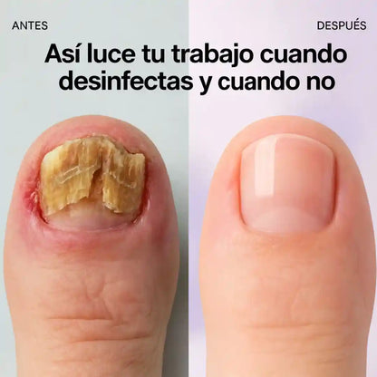 Olvídate de las infecciones y la mala reputación con Cleany™