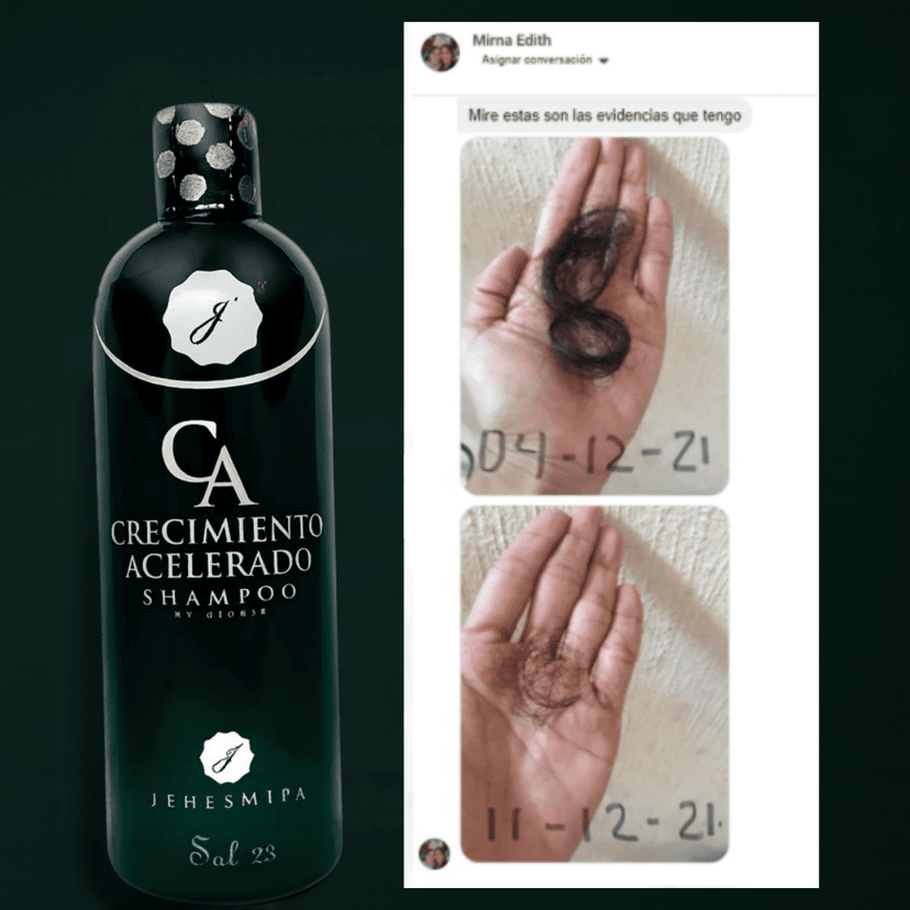 RootBoost Kit Anti-caída y crecimiento acelerado + 1 Karseell GRATIS