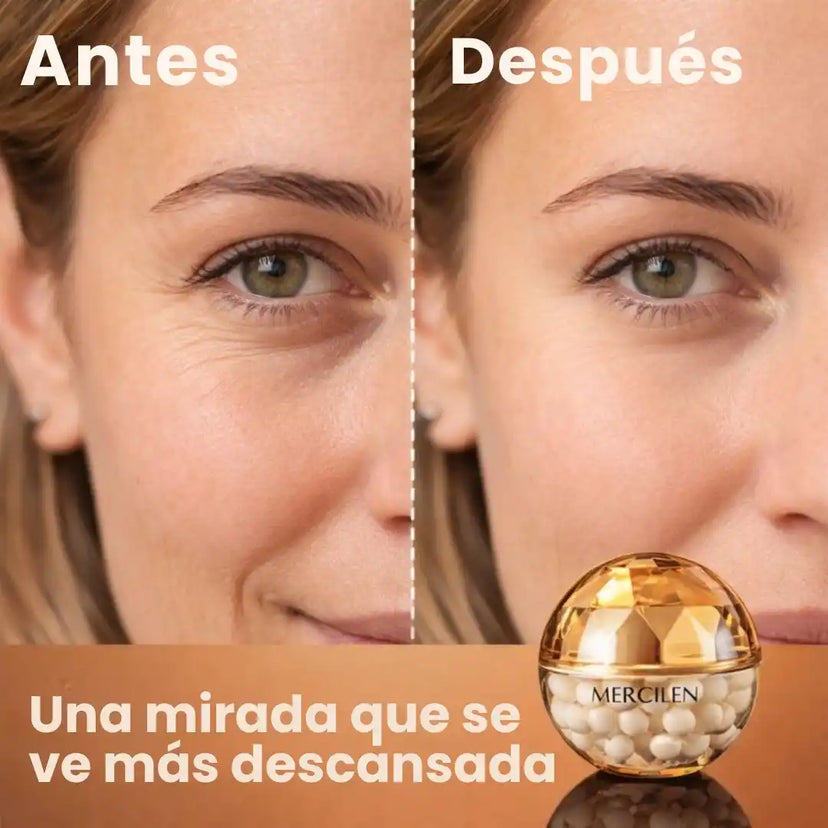 Recupera una mirada descansada todos los días con Mercilen™