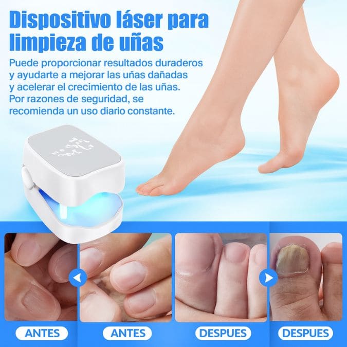 NailClean™ - Tratamiento para Uñas que Limpia Hongos Fácil y sin Dolor