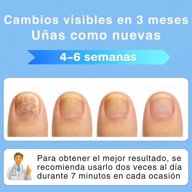 NailClean™ - Tratamiento para Uñas que Limpia Hongos Fácil y sin Dolor